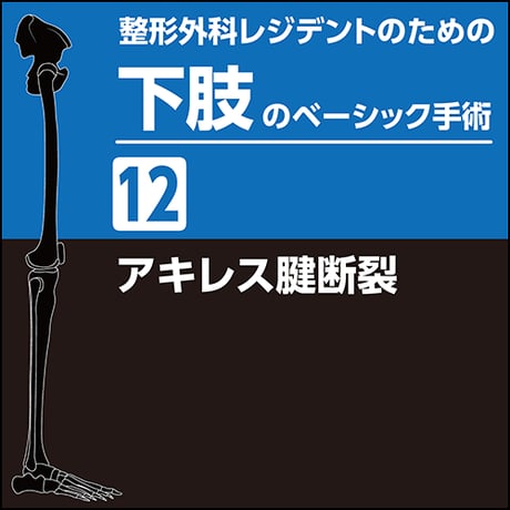 整形外科レジデントのための下肢のベーシック手術12　アキレス腱断裂（PDF版）