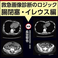 救急画像診断のロジック〜腸閉塞・イレウス編