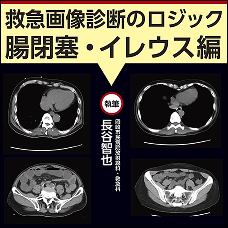 救急画像診断のロジック〜腸閉塞・イレウス編 | 日本医事新報社 Web 