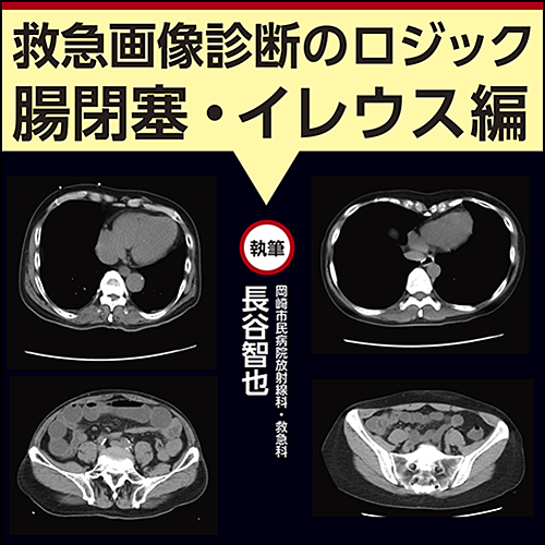 救急画像診断のロジック〜腸閉塞・イレウス編 | 日本医事新報社