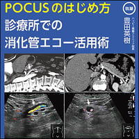 POCUSのはじめ方〜診療所での消化管エコー活用術