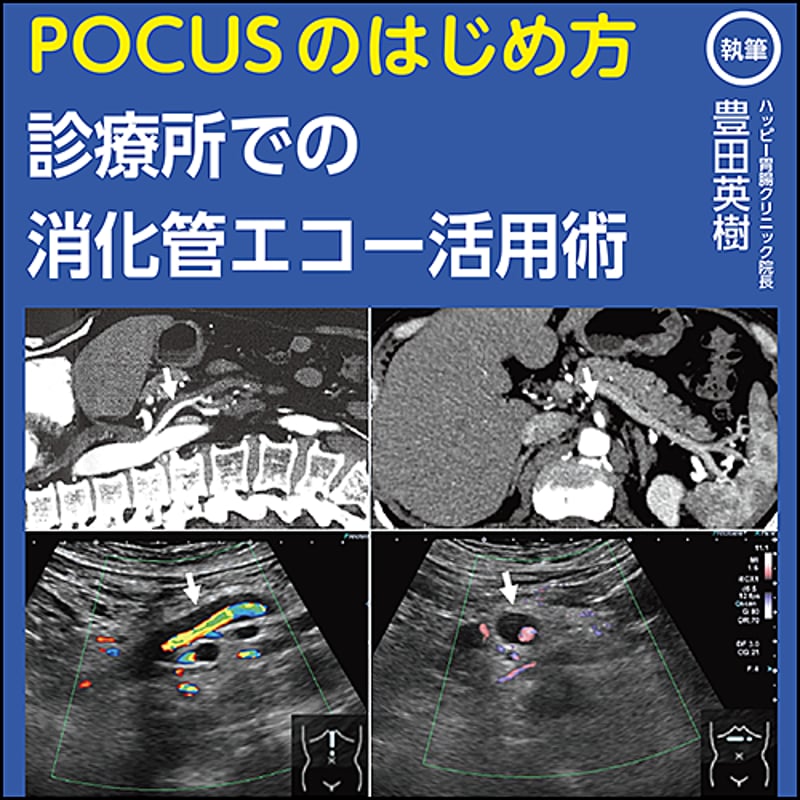 POCUSのはじめ方〜診療所での消化管エコー活用術 | 日本医事新報社 Web