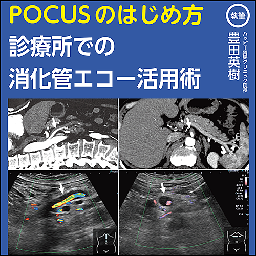 POCUSのはじめ方〜診療所での消化管エコー活用術 | 日本医事新報社 Web
