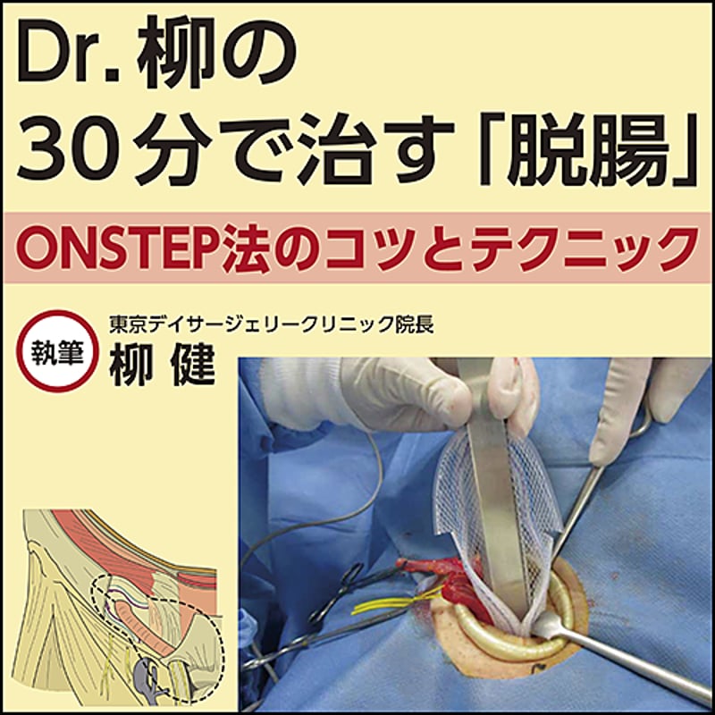Dr.柳の30分で治す「脱腸」〜ONSTEP法のコツとテクニック | 日本医事新