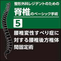 整形外科レジデントのための上肢のベーシック手術7 骨折治療2