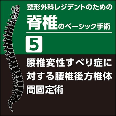 整形外科レジデントのための脊椎のベーシック手術5　腰椎変性すべり症に対する腰椎後方椎体間固定術（PDF版）