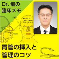 胃管の挿入と管理のコツ〜Dr.畑の臨床メモ