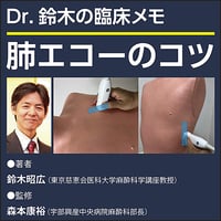 肺エコーのコツ〜Dr.鈴木の臨床メモ