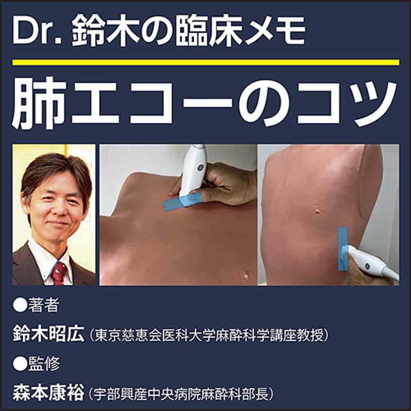 肺エコーのコツ〜Dr.鈴木の臨床メモ | 日本医事新報社 Webコンテンツ