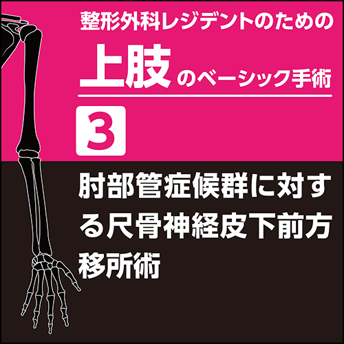 整形外科レジデントのための上肢のベーシック手術3 肘部管症候群