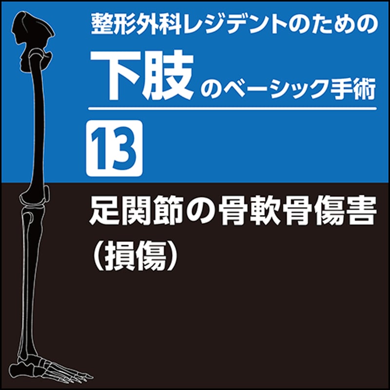 整形外科レジデントのための下肢のベーシック手術13 足関節の骨軟骨