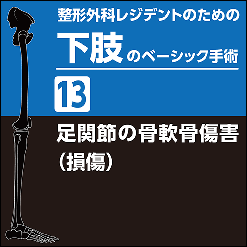 整形外科レジデントのための下肢のベーシック手術13 足関節の骨軟骨