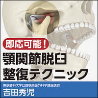即応可能！顎関節脱臼整復テクニック