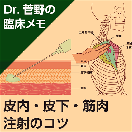 皮内・皮下・筋肉注射のコツ〜Dr.菅野の臨床メモ | 日本医事新報社 Web