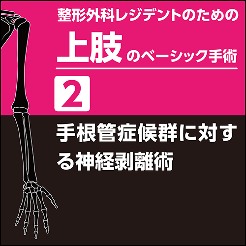 整形外科レジデントのための上肢のベーシック手術2 手根管症候群