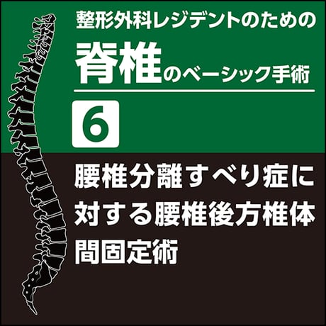 整形外科レジデントのための脊椎のベーシック手術6　腰椎分離すべり症に対する腰椎後方椎体間固定術（PDF版）