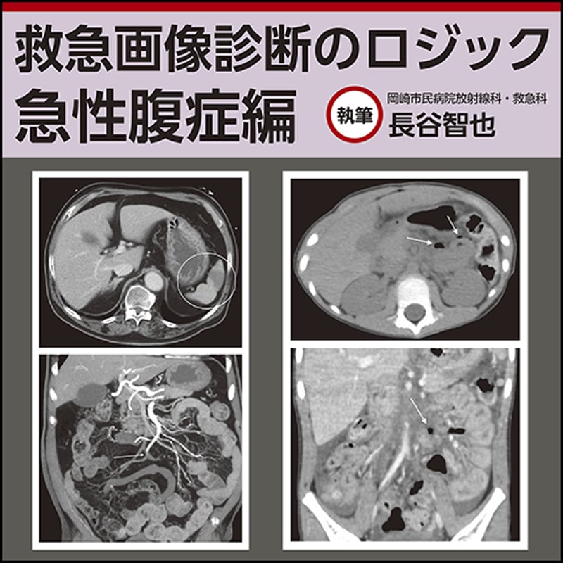 救急画像診断のロジック〜急性腹症編 | 日本医事新報社 Webコンテンツ