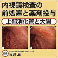 内視鏡検査の前処置と薬剤投与〜上部消化管と大腸