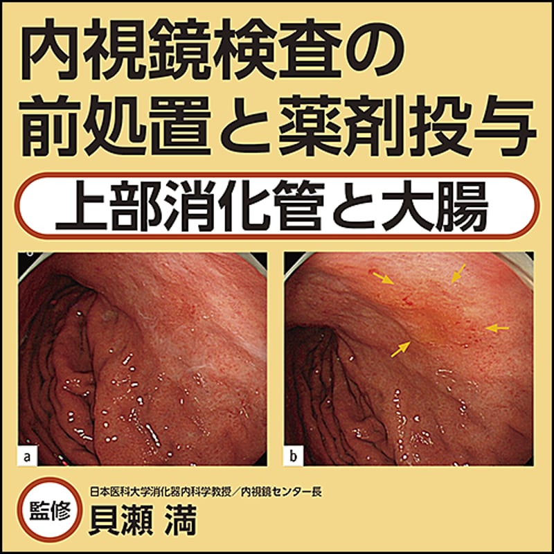 内視鏡検査の前処置と薬剤投与〜上部消化管と大腸 | 日本医事新