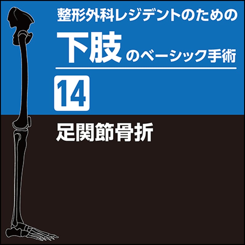 整形外科レジデントのための下肢のベーシック手術14 足関節骨折