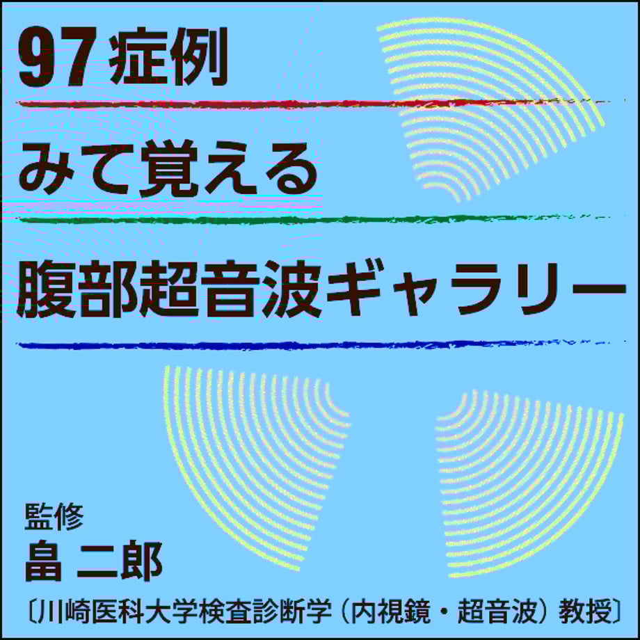 5ca5a6b9b9d5f478ae3ce1ac