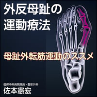 外反母趾の運動療法〜母趾外転筋運動のススメ