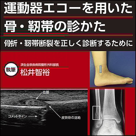 運動器エコー」シリーズ | STORES 運動器エコー」シリーズ | STORES