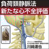 負荷頚静脈法：新たな心不全評価