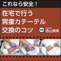 これなら安全！ 在宅で行う胃瘻カテーテル交換のコツ