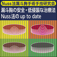 【Nuss法漏斗胸手術手技研究会】漏斗胸の安全・低侵襲な治療法〜Nuss法のup to date