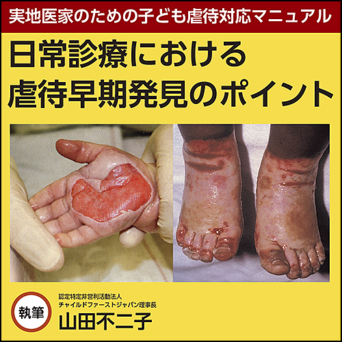 子ども虐待の身体所見 実地医家のための子ども虐待対応マニュアル〉日常診療における虐待早期