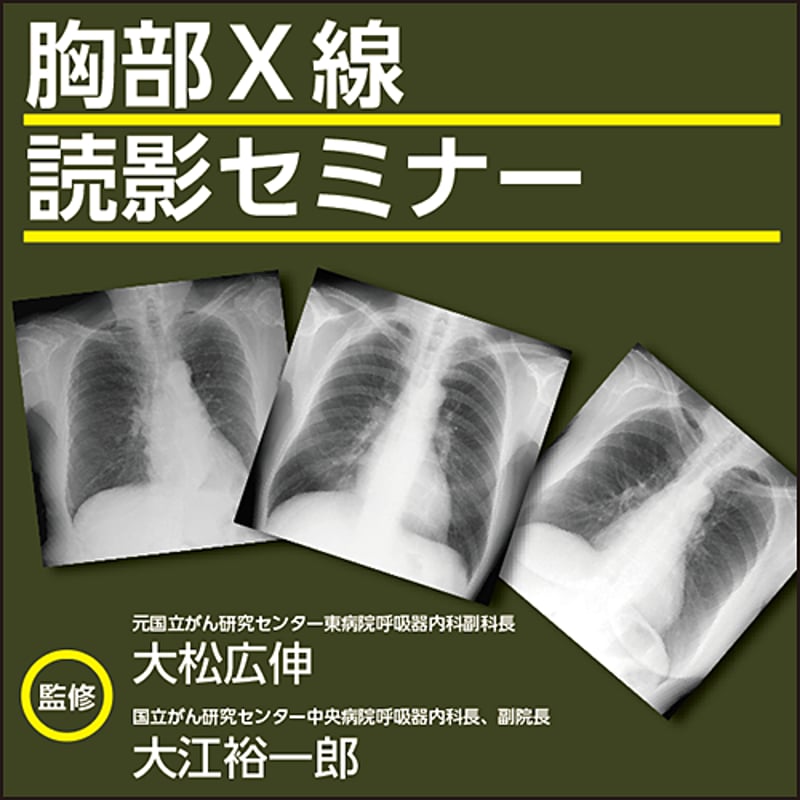 胸部X線読影セミナー | 日本医事新報社 Webコンテンツ販売サイト