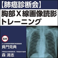 【肺癌診断会】胸部X線画像読影トレーニング