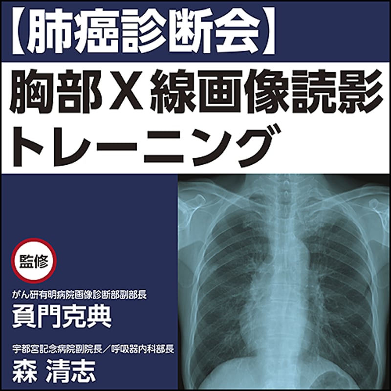 肺癌診断会】胸部X線画像読影トレーニング | 日本医事新報社 Web