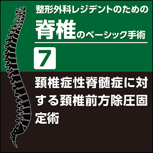 整形外科レジデントのための脊椎のベーシック手術7 頚椎症性脊髄