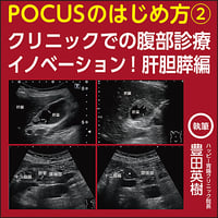 POCUSのはじめ方②〜クリニックでの腹部診療イノベーション！肝胆膵編