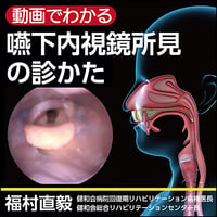 〈動画でわかる〉嚥下内視鏡所見の診かた