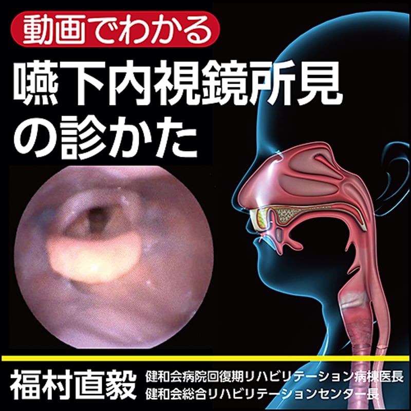 動画でわかる〉嚥下内視鏡所見の診かた | 日本医事新報社 Web