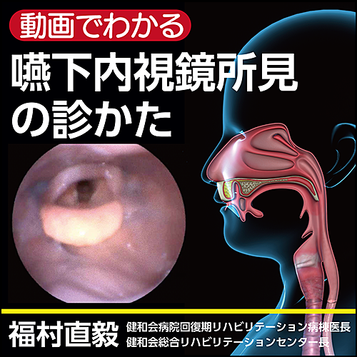 動画でわかる〉嚥下内視鏡所見の診かた | 日本医事新報社 Web