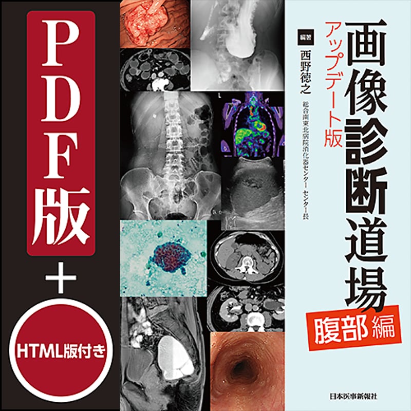 画像診断道場 アップデート版＜腹部編＞ | 日本医事新報社 Web