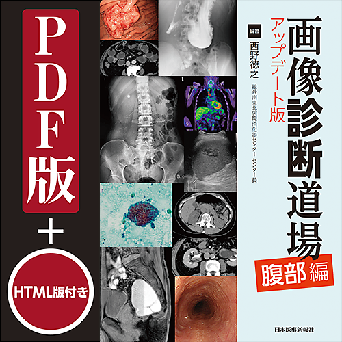 画像診断道場 アップデート版＜腹部編＞ | 日本医事新報社 Web