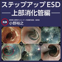 ステップアップESD〜上部消化管編