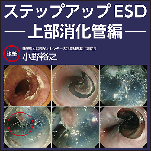 ステップアップESD〜上部消化管編 | 日本医事新報社 Web ステップアップESD〜上部消化管編 | 日本医事新報社 Web