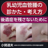 乳児血管腫の診かた・考えかた〜後遺症を残さないために