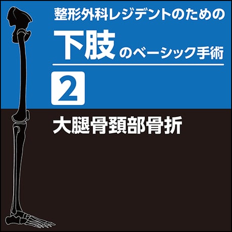 整形外科レジデントのための下肢のベーシック手術2　大腿骨頚部骨折（PDF版）