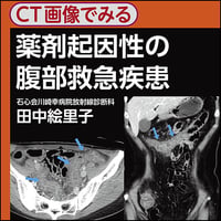 CT画像でみる薬剤起因性の腹部救急疾患