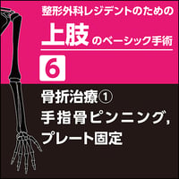 整形外科レジデントのための上肢のベーシック手術6　骨折治療1　手指骨ピンニング，プレート固定（PDF版）