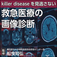 〈killer diseaseを見逃さない〉救急医療の画像診断