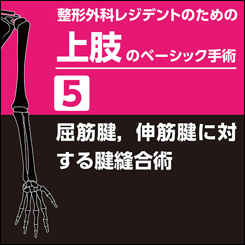 整形外科レジデントのための上肢のベーシック手術5 屈筋腱，伸筋腱