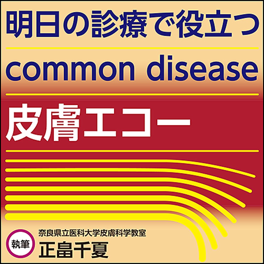61ea3551fd2e735f5b388448